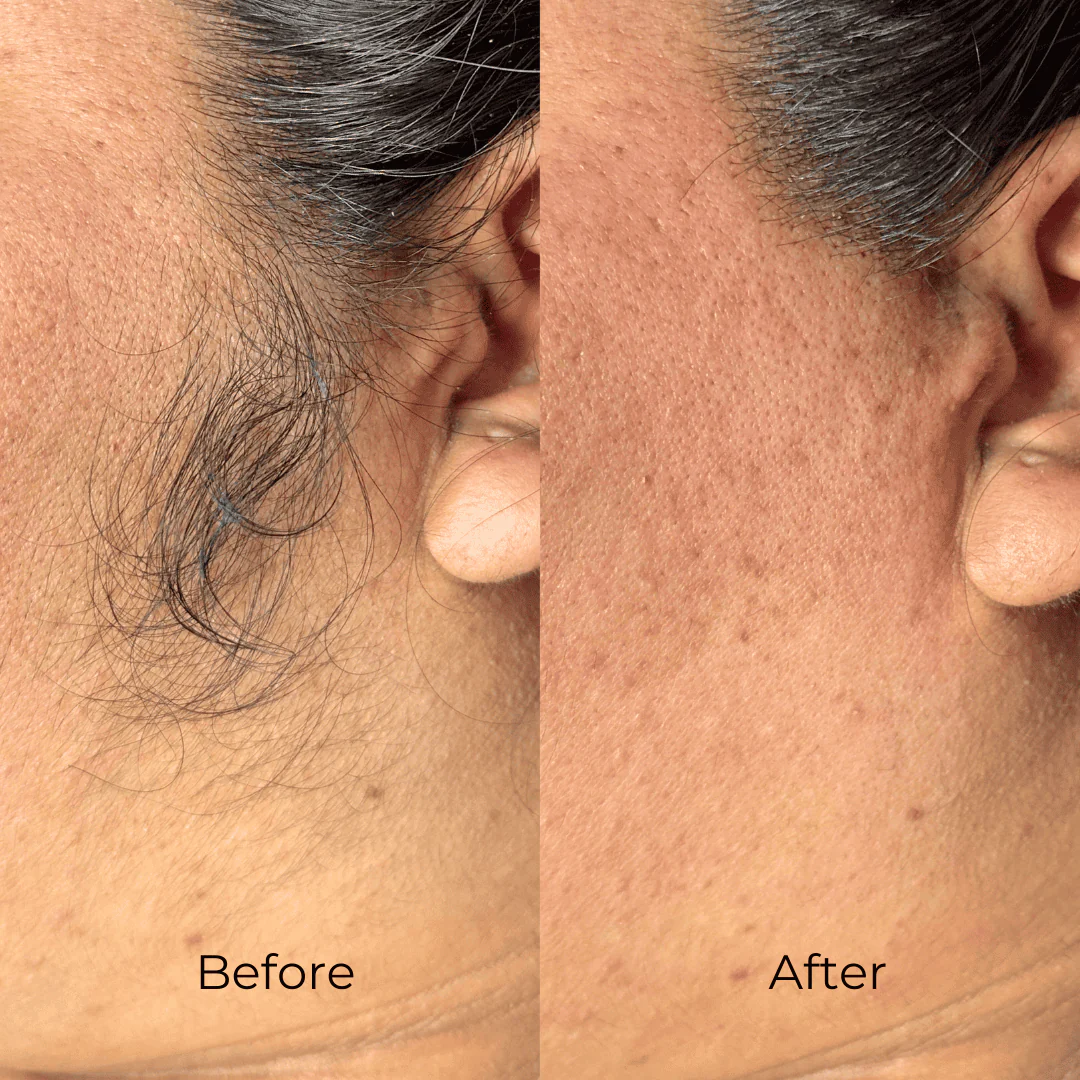 Beginner Esthetician Waxing Kits - Image 8