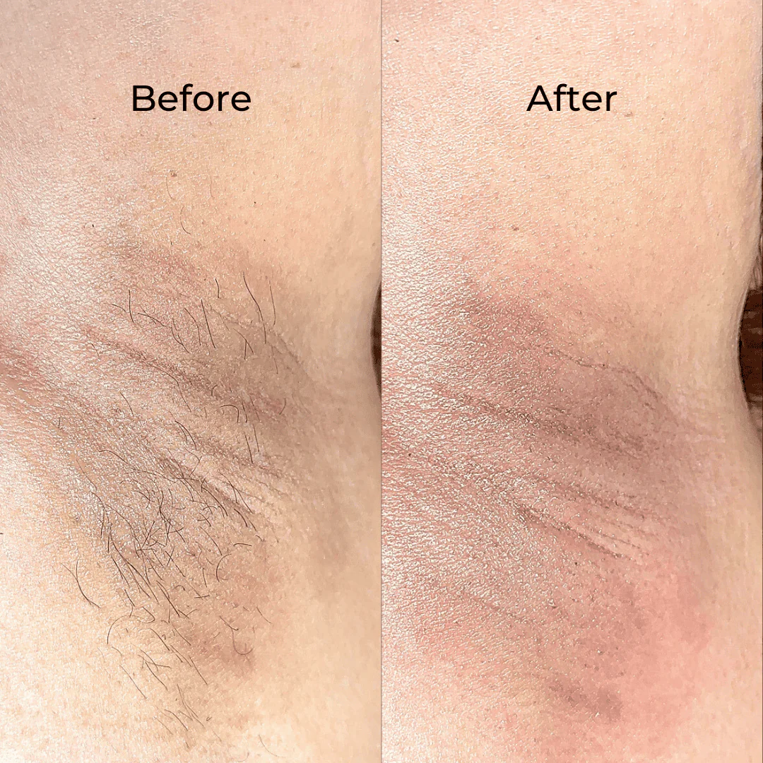 Eco Conscious Waxing Kit - Image 8