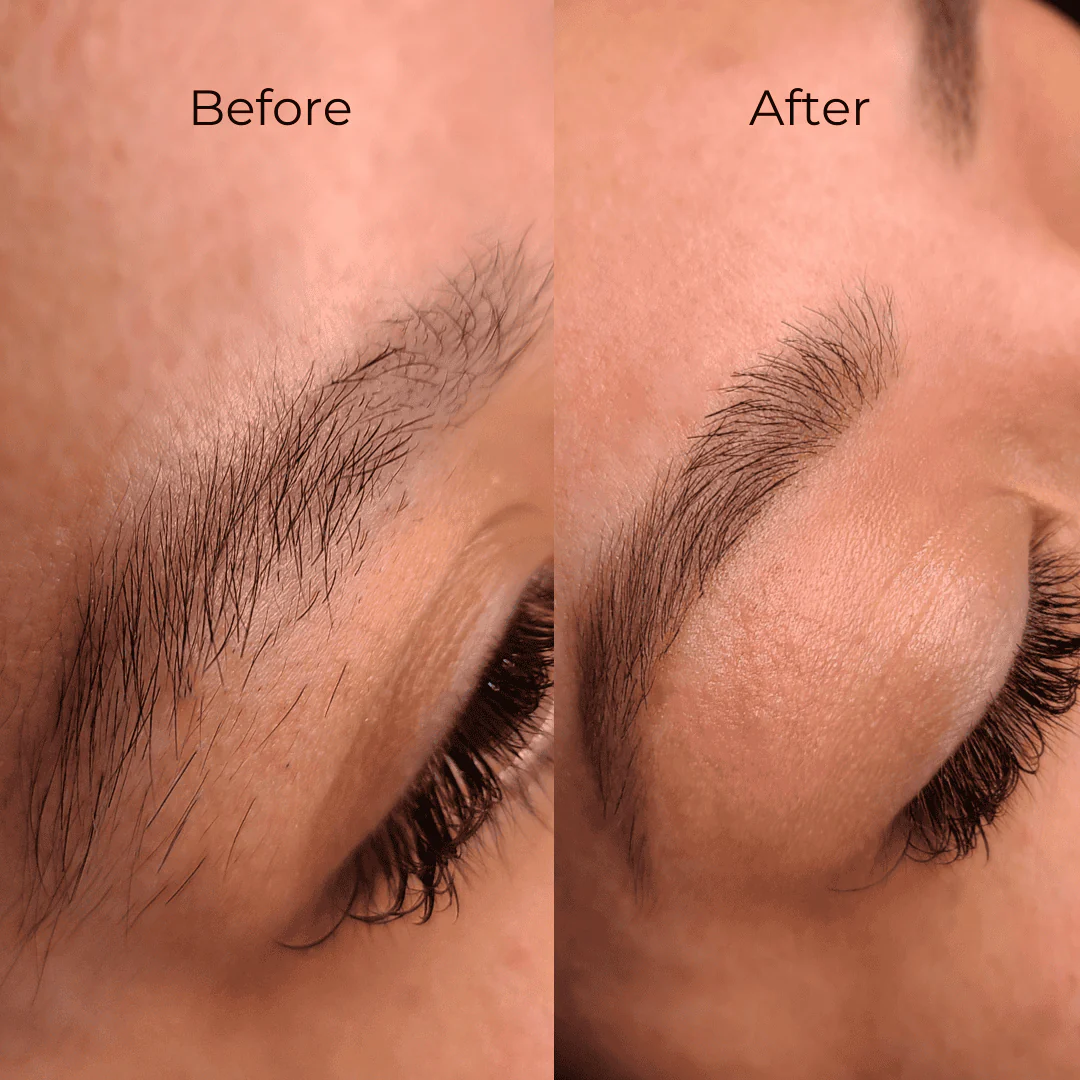 Professional Facial Waxing Kits - Image 9