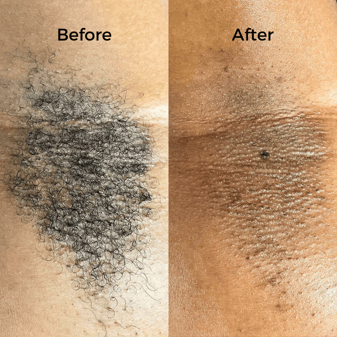 Full Body Waxing Kits - Image 12