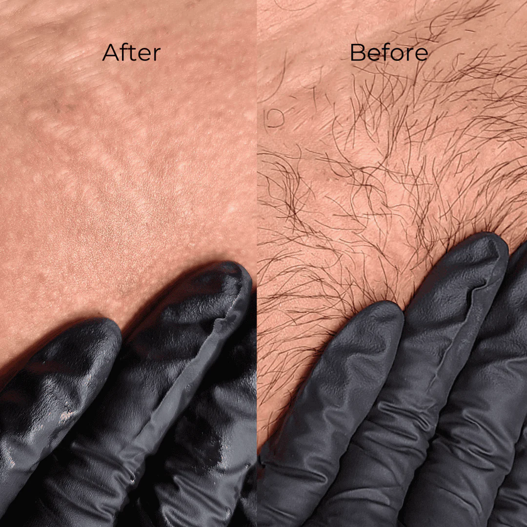 Professional Brazilian Waxing Kits for Estheticians - Image 7
