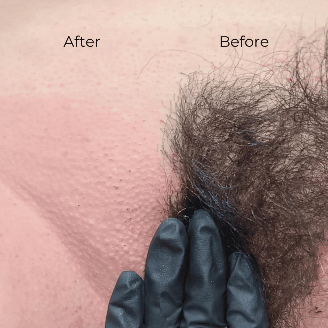 Professional Brazilian Waxing Kits for Estheticians - Image 8