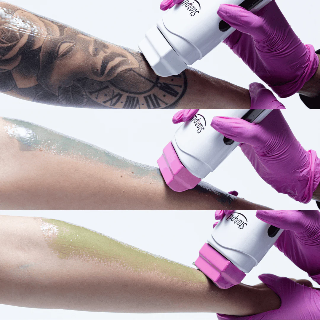 Speed Waxing Kits - Image 11