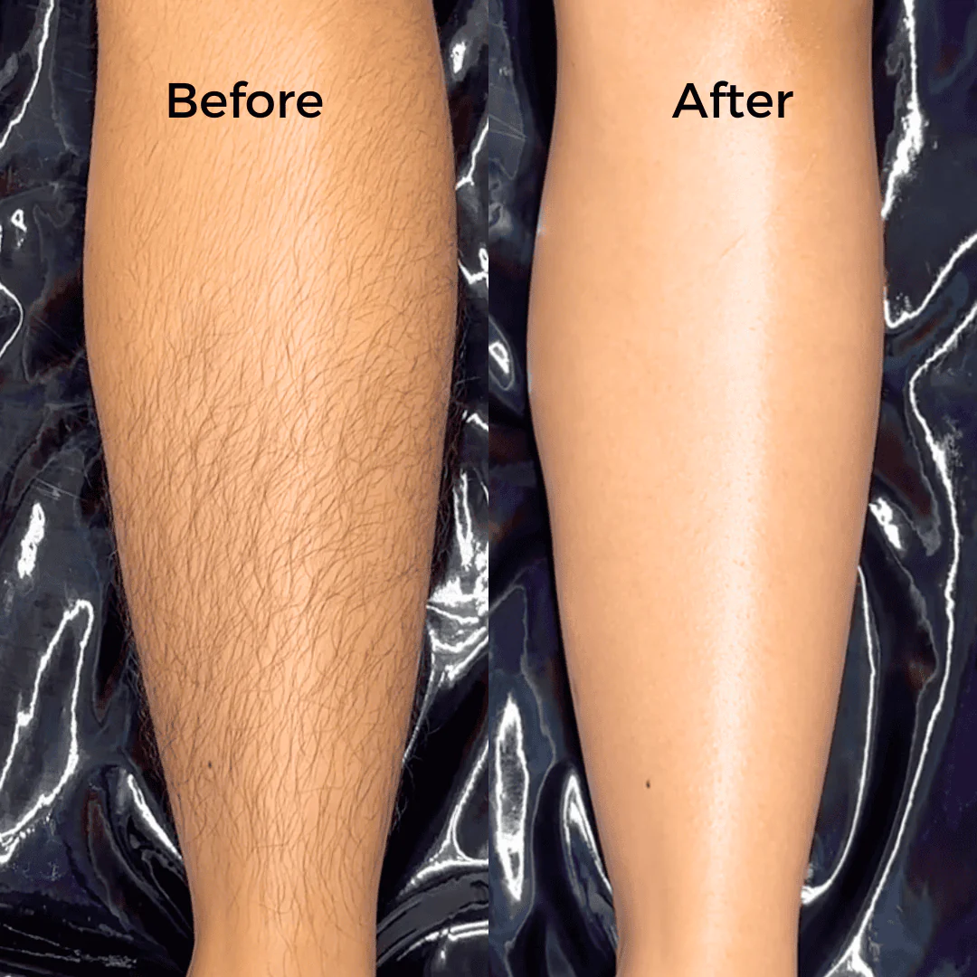 Speed Waxing Kits - Image 13