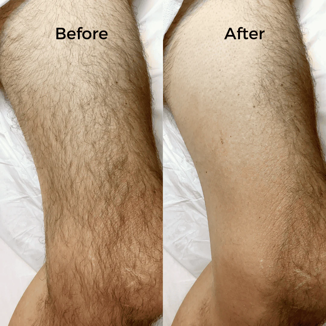 Speed Waxing Kits - Image 14