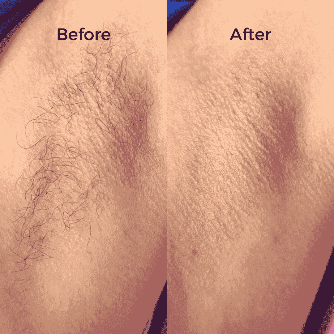 Full Body Waxing Kits - Image 11